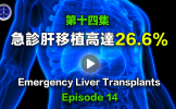 第14集 急诊肝移植高达26.6%